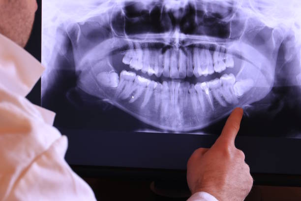 Best Weekend Emergency Dental Services in Lambertville, NJ